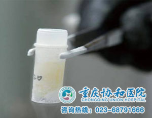 死精症有什么症状表现